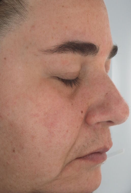 baseline image firming serum