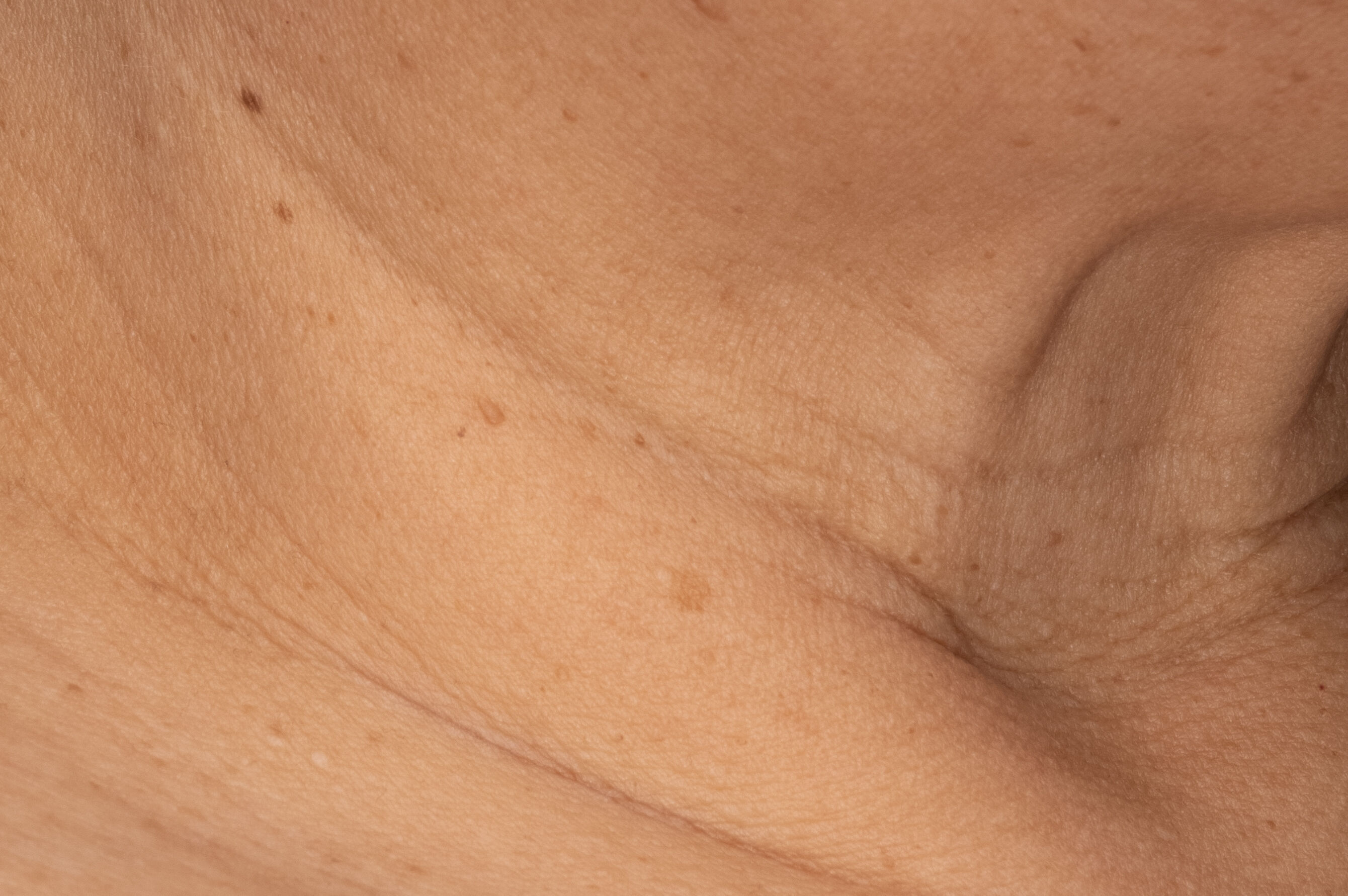 Before and After after 2 weeks of Recovery Crème Usage