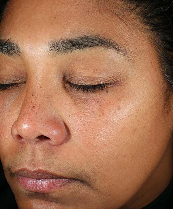 Before and After Image of results from 8 weeks of Daily Power Defense