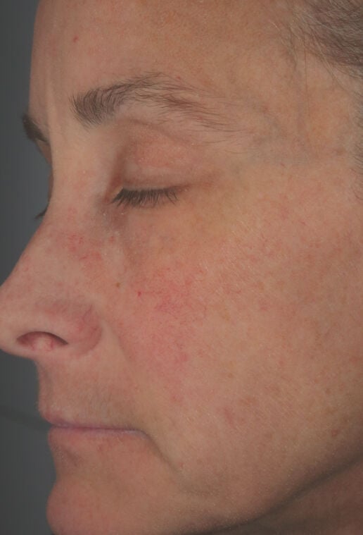 Hydrating Cr&egrave;me  before-after-3