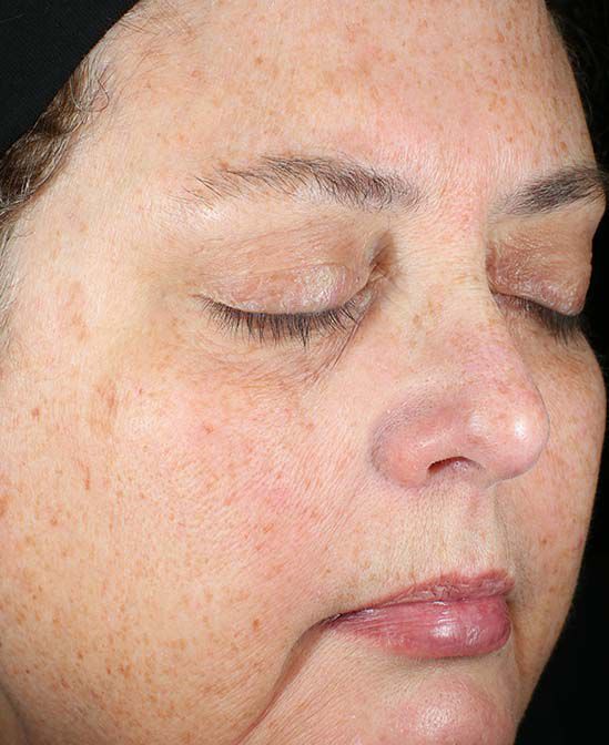 Before and After Image of results from 8 weeks of Daily Power Defense