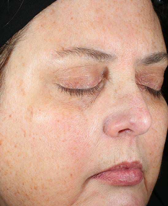 Before and After Image of results from 8 weeks of Daily Power Defense