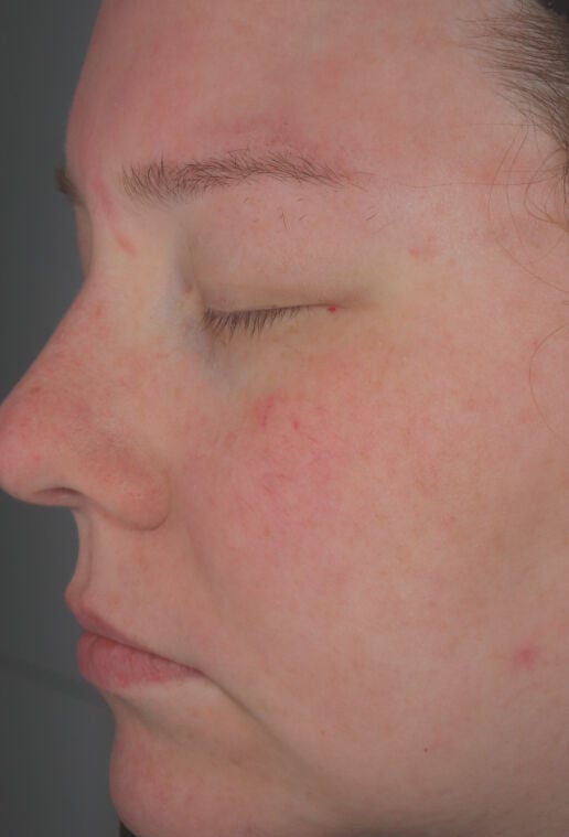 Hydrating Cr&egrave;me  before-after-2