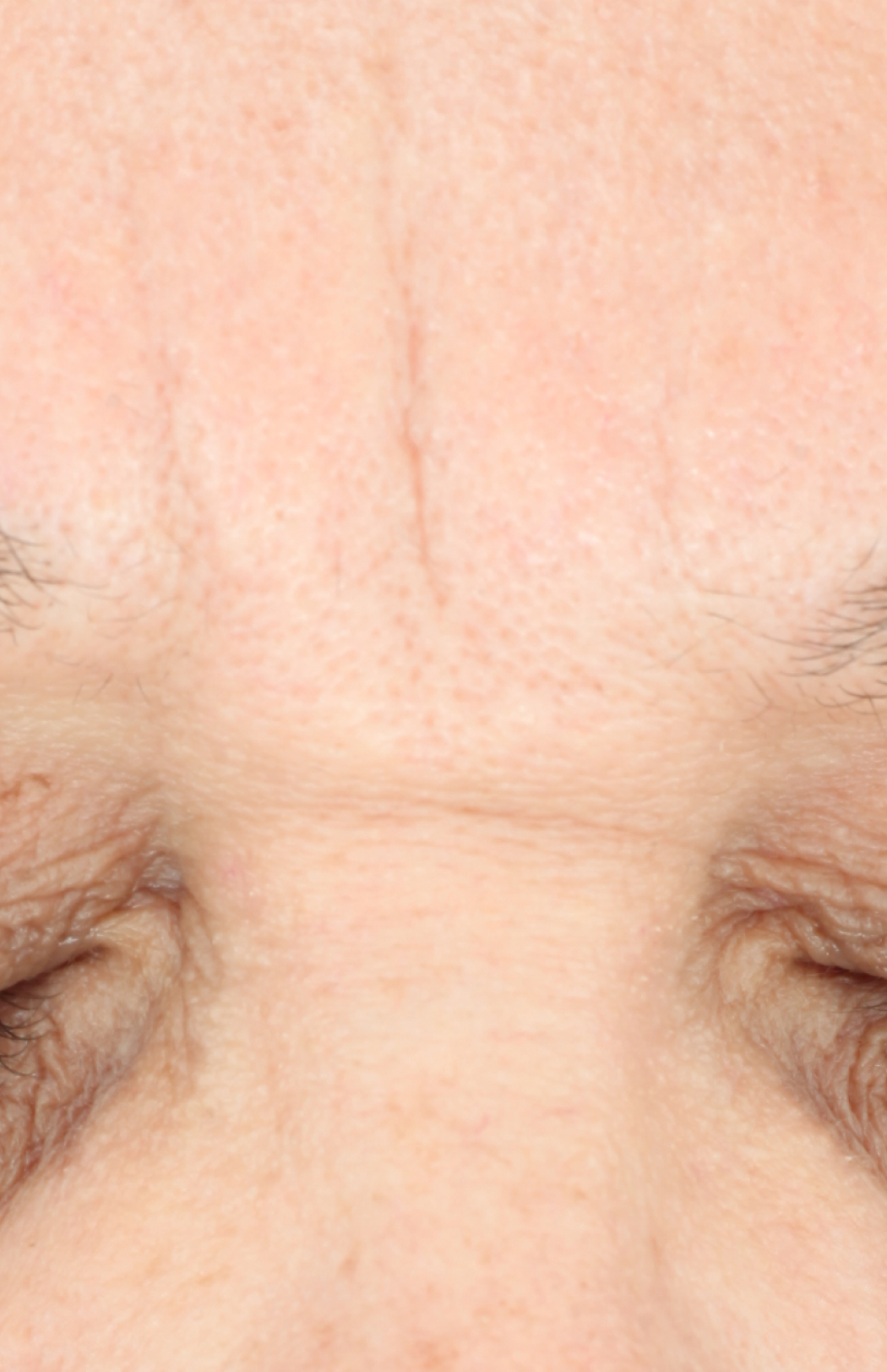 Growth Factor Serum  before-after-1