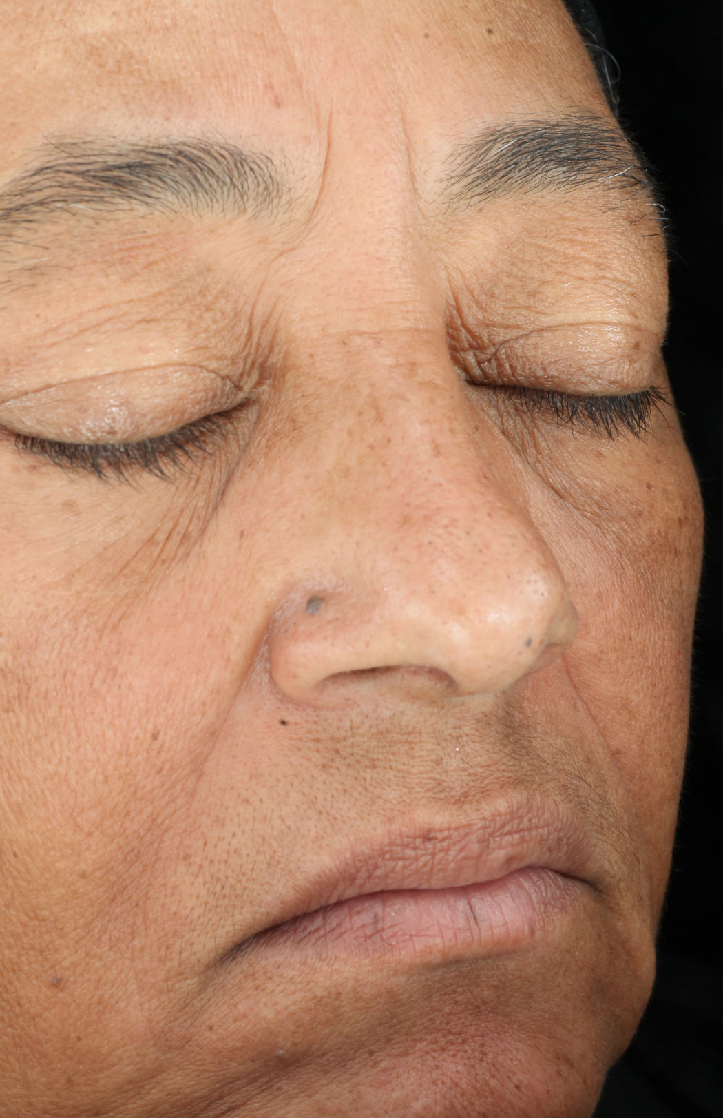Growth Factor Serum  before-after-2