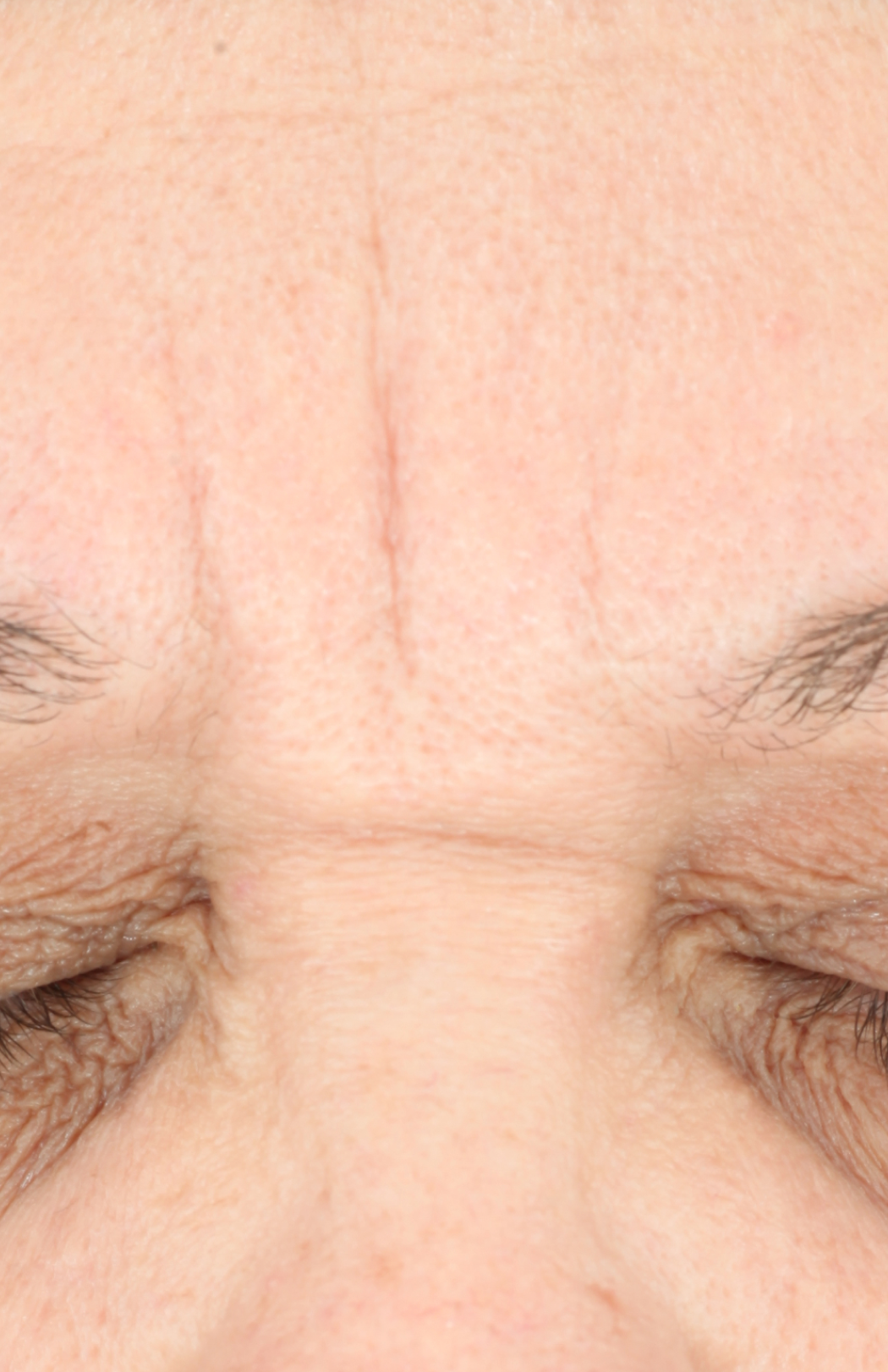 Growth Factor Serum  before-after-1