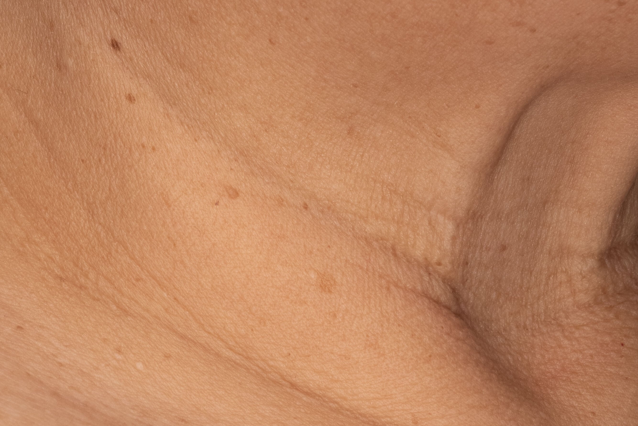 Before and After after 2 weeks of Recovery Cr&egrave;me Usage